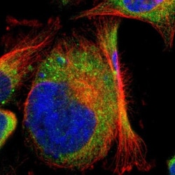 CLCC1 Antibody, Novus Biologicals 0.1mL; Unlabeled:Antibodies, Polyclonal